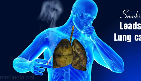 causes-of-lung-cancer-smoking